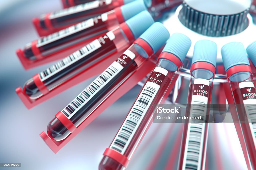 Lab utrustning centrifugering blod. Begreppet bild av en blod test.3d rendering. - Royaltyfri Blodprov Bildbanksbilder