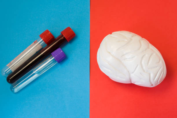 istock Laboratory diagnosis of metabolic function, diseases, biochemical violations, damage of brain and cerebrospinal fluid. Brain and laboratory test tubes wit blood and cerebrospinal fluid lie opposite 902946716