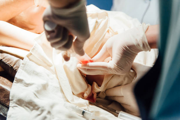 istock surgeon making surgery for patient with pneumonia 903195560