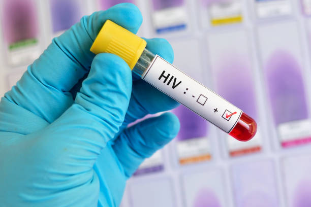 échantillon de sang positifs de vih - test du sida photos et images de collection