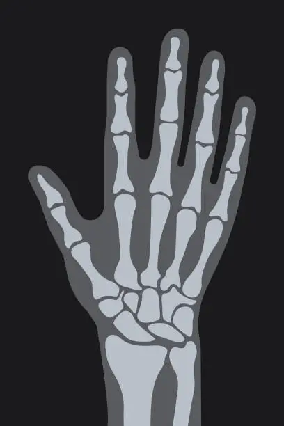 Vector illustration of vector x-ray hand
