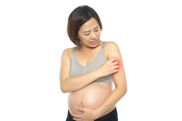 istock Pregnant woman with mosquitoes bite 904269924