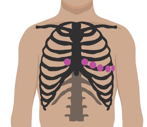 umieszczenie przewodów klatki piersiowej ekg - klatka piersiowa tułów stock illustrations