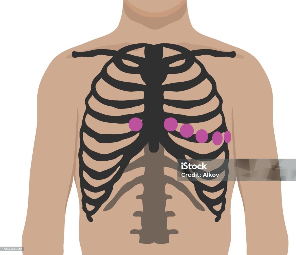 ECG Chest Leads Placement Vector illustration of the ECG chest leads Electrocardiography stock vector