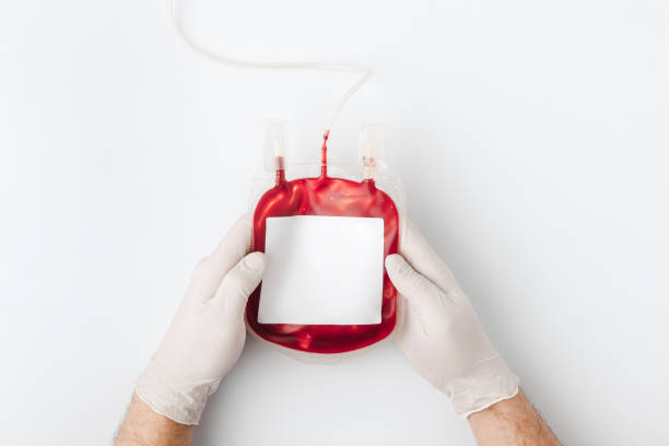 vista superior das mãos em luvas segurando o sangue para transfusão - donors choose - fotografias e filmes do acervo