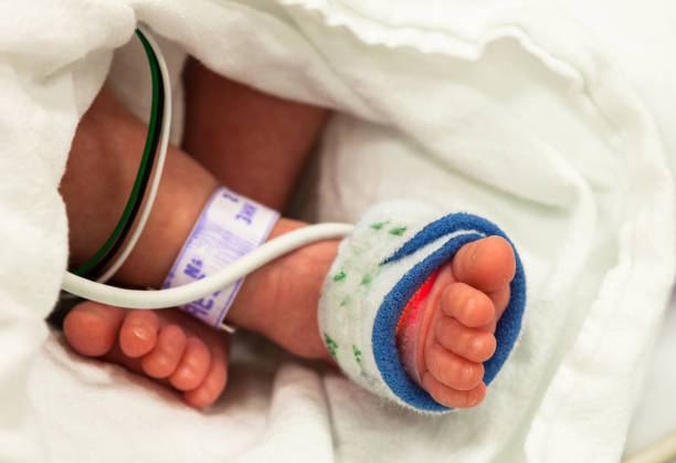 fuße des eine frühgeburt in der neonatalen intensivstation - baby toe stock-fotos und bilder