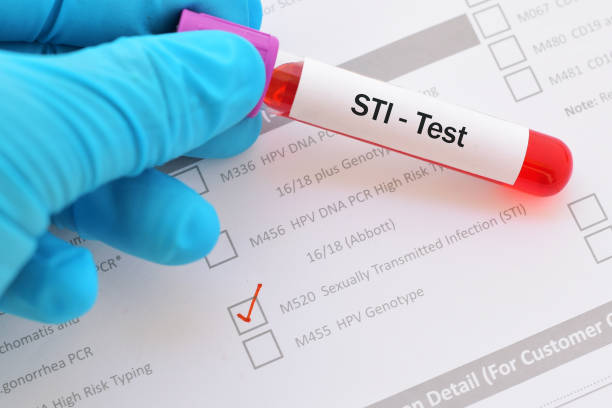 sti test - technology research analyzing bacterium imagens e fotografias de stock