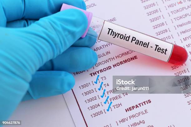 Hyperthyroid Panel Thyroid Panel Test Stock Photo - Download Image Now - Cancer - Illness ...