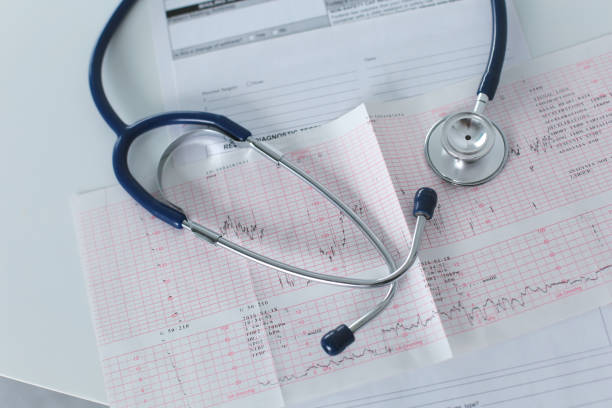 istock docter workplace with a stethoscope Cardiogram chart with medical table closeup,for heart record 904683502