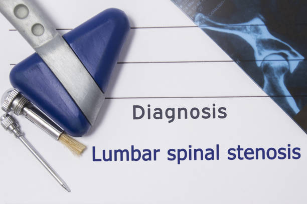 Neurological diagnosis of Lumbar Spinal Stenosis. Neurologist directory, where is printed diagnosis Lumbar Spinal Stenosis, lies on workplace with MRI image and neurological diagnostic tools close-up diagnóstico neurológico de la estenosis espinal lumbar. directorio de neurólogo, diagnóstico impreso dónde está la estenosis espinal lumbar, se encuentra en el lugar de trabajo con imagen y primer plano de las herramientas de diagnóstico neurológico