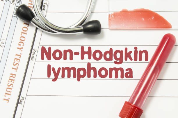 diagnosis of non-hodgkin lymphoma. laboratory blood bottle, glass slide with blood smear, hematology test, stethoscope lying on note with printed text hematological diagnosis of non hodgkin lymphoma - non hodgkin lymphoma imagens e fotografias de stock