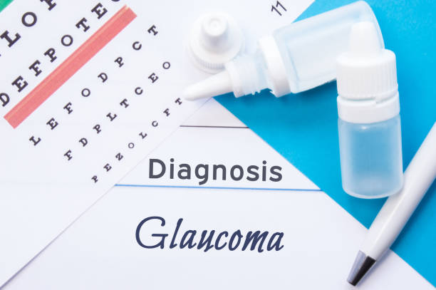 diagnostic d’ophtalmologie glaucome. diagramme de snellen (œil), deux bouteilles de gouttes pour les yeux (médicaments) se trouvant sur ordinateur portable avec le diagnostic de glaucome inscription sur le bureau dans le bureau de l’ophtalmologiste - eyes narrowed photos et images de collection