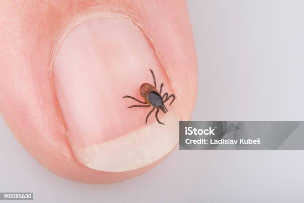 Closeup Of Castor Bean Tick On Human Nail Ixodes Ricinus Stock Photo - Download Image Now
