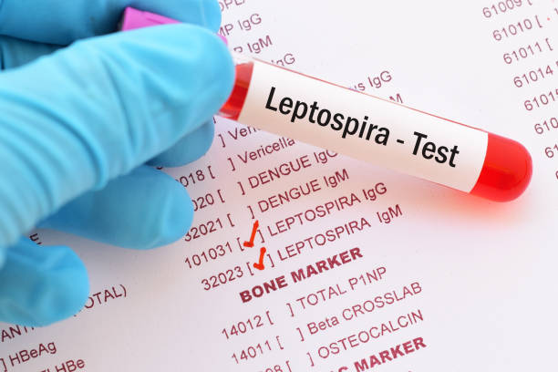Leptospira test Blood sample with requisition form leptospira test leptospira stock pictures, royalty-free photos & images