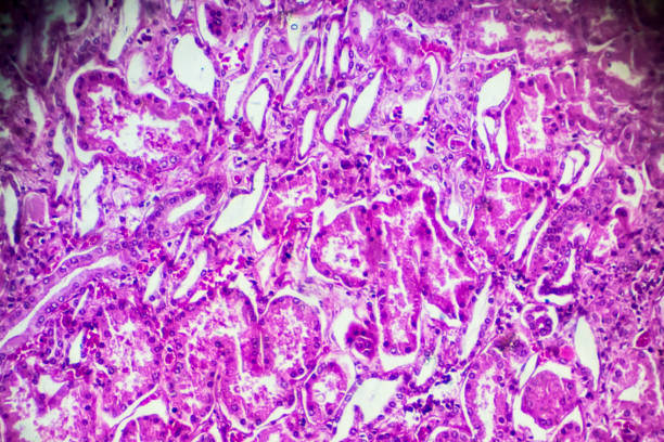 istock Kidney proximal tubule epithelial cloudy SWELLING 905379784