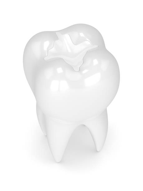 istock 3d render of tooth with dental composite filling 905428944
