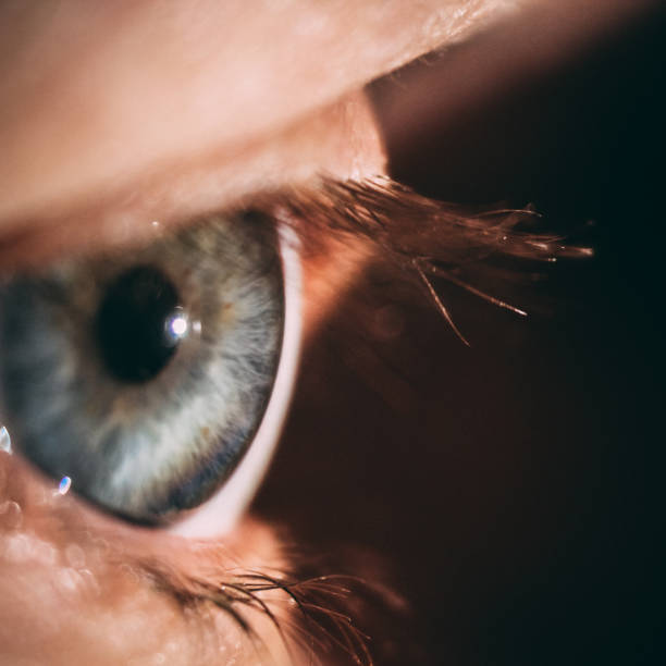 istock enlarged image of an eye iris made with a slit lamp 905434562
