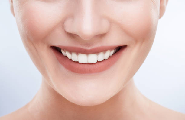 istock Snow-white woman smile 905575008