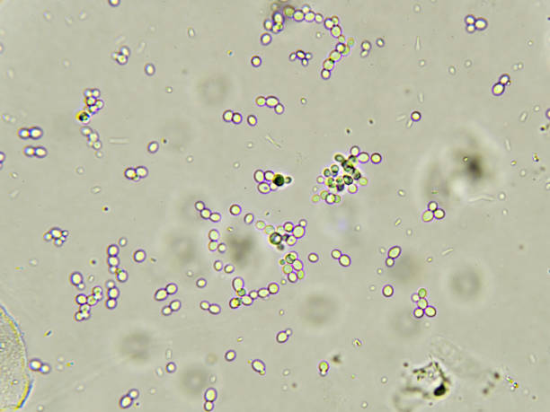 spirande jästceller i urin - klamydiatest bildbanksfoton och bilder