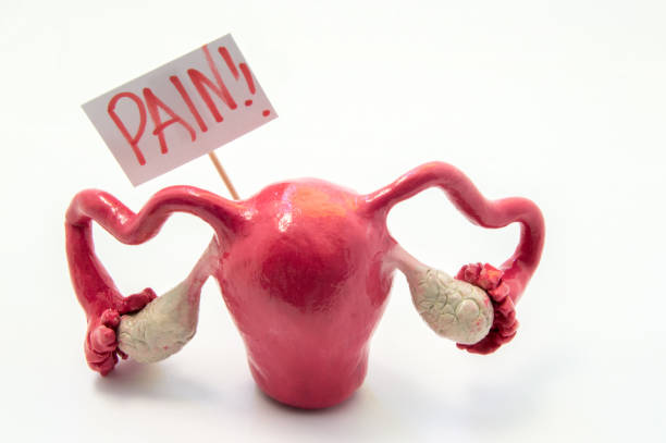 Illustration concept of pain symptom or syndrome in pathologies and diseases of female genitals as PMS, endometriosis. Anatomical model of uterus is next to poster on which written in red word pain Illustration concept of pain symptom or syndrome in pathologies and diseases of female genitals as PMS, endometriosis. Anatomical model of uterus is next to poster on which written in red word pain polycystic ovary syndrome photos stock pictures, royalty-free photos & images