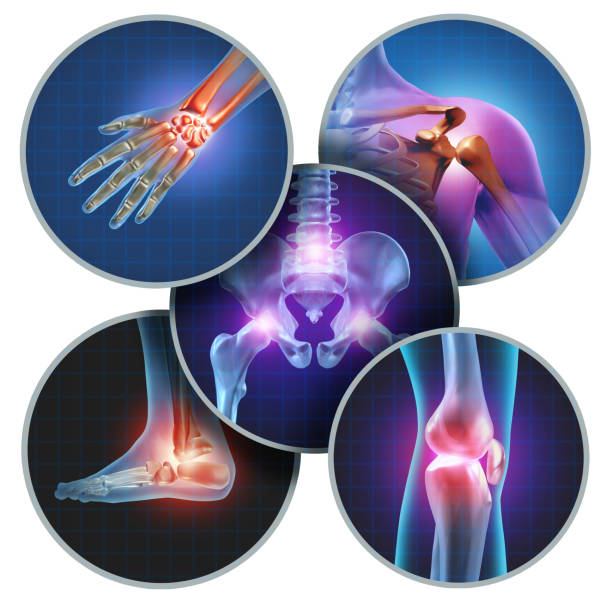 Human Painful Joints Human painful joints concept with the skeleton anatomy of the body with a group of sores with glowing joint pain and injury or arthritis illness symbol for health care and medical symptoms. joint body part photos stock pictures, royalty-free photos & images