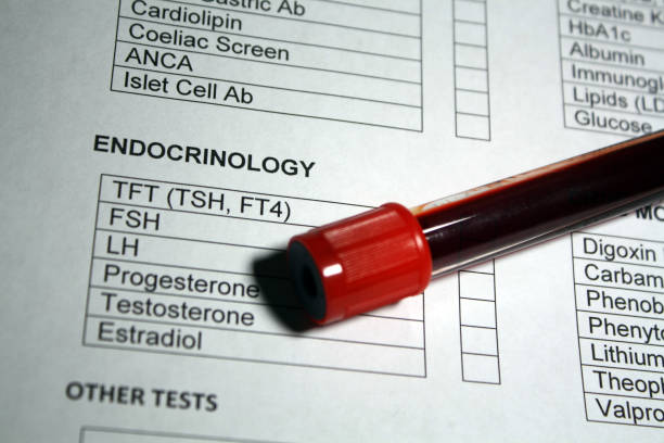 muestra de hematología endocrinología - progesterona fotografías e imágenes de stock