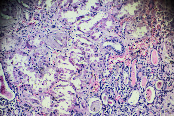 istock Hypertension disease renal different area under microscopy 905890718
