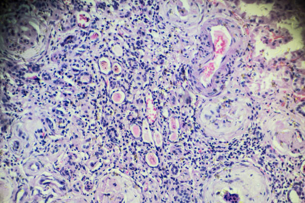 istock Hypertension disease renal different area under microscopy 905891070