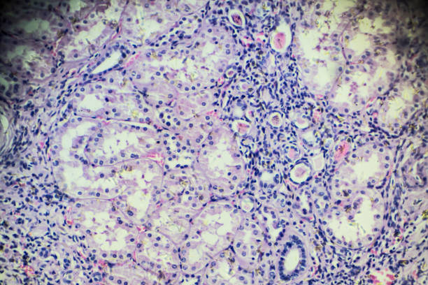 istock Hypertension disease renal different area under microscopy 905896934