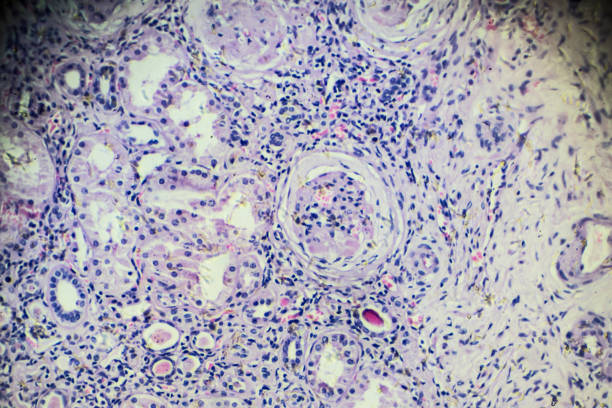 istock Hypertension disease renal different area under microscopy 905897214