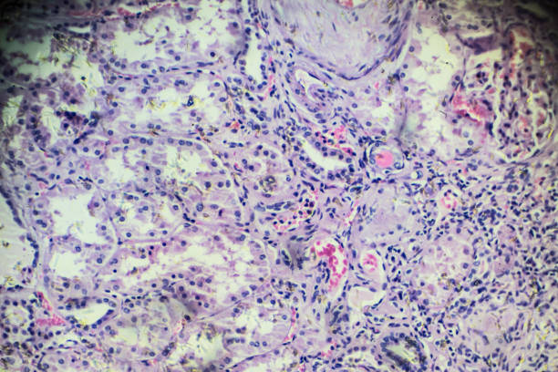 istock Hypertension disease renal different area under microscopy 905898156