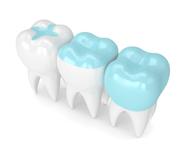istock 3d render of teeth with different types of filling 905948996