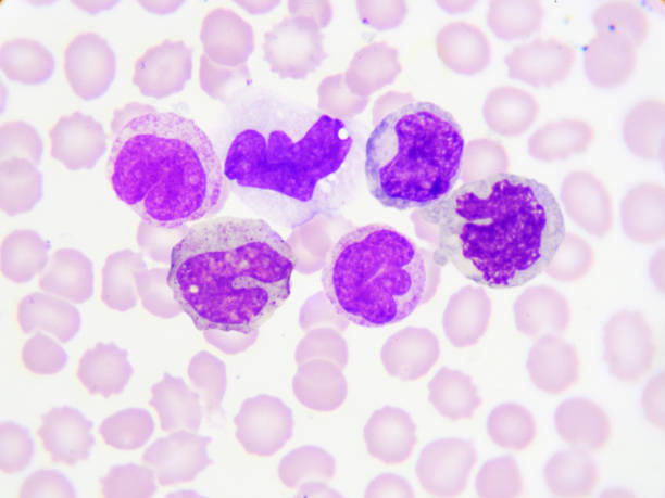 istock White blood cells in blood smear 905957534