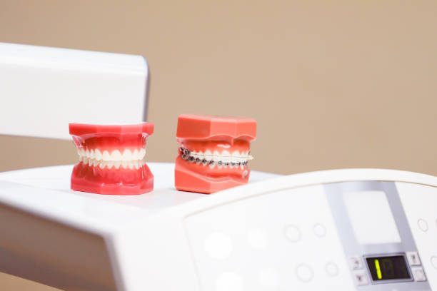 istock Perfectly straight teeth. Jaw model, close up. Braces on the teeth. 905960118