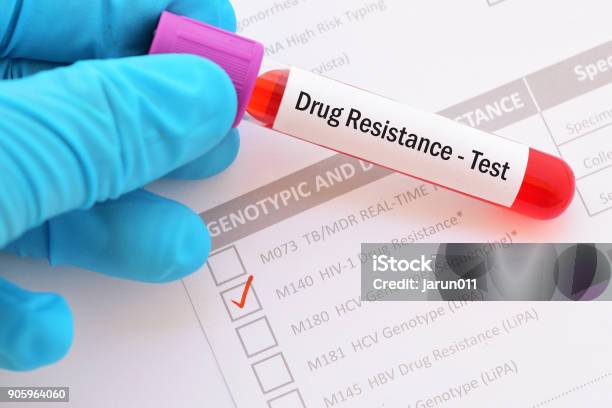 Hiv Drugs Resistance Test Stock Photo - Download Image Now - HIV, AIDS, Analyzing