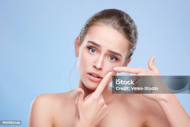 Disappointed Girl Looking At Camera Stock Photo - Download Image Now - Acne, Pimple, Skin
