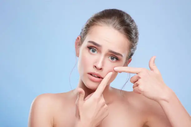 Beauty concept, head and shoulders of young woman with natural makeup. Disappointed girl looking at camera sadly and pressing out pimple on skin. Studio, indoors