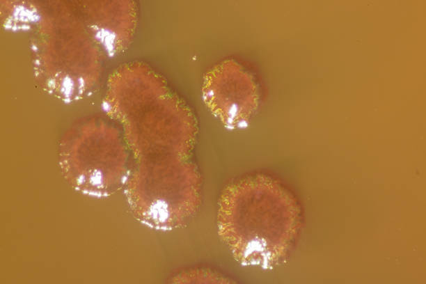 Colony Characteristics of Escherichia coli (E. coli) is a Gram-negative, facultatively anaerobic, rod-shaped, coliform bacterium of the genus Escherichia that is commonly found in the lower intestine of warm-blooded organisms (endotherms) of microbiology for education in Lab. colonias características de escherichia coli (e. coli) es una bacteria gram negativa, facultativamente anaerobia, en forma de barra, coliforme del género escherichia que se encuentra comúnmente en el intestino más bajo de los organismos de sangre caliente (los endotherms) de microbiología