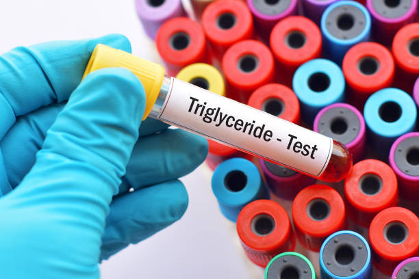 Triglyceride test stock photo