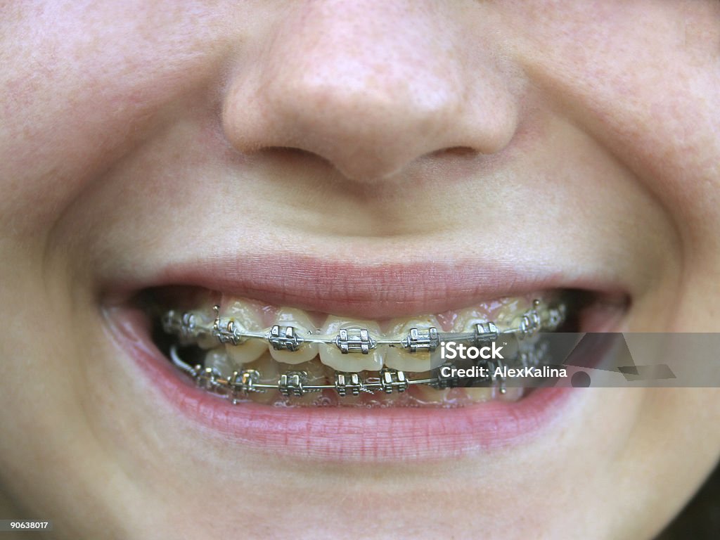 PHRASES ENTRE CROCHETS sur les dents - Photo de Adolescence libre de droits