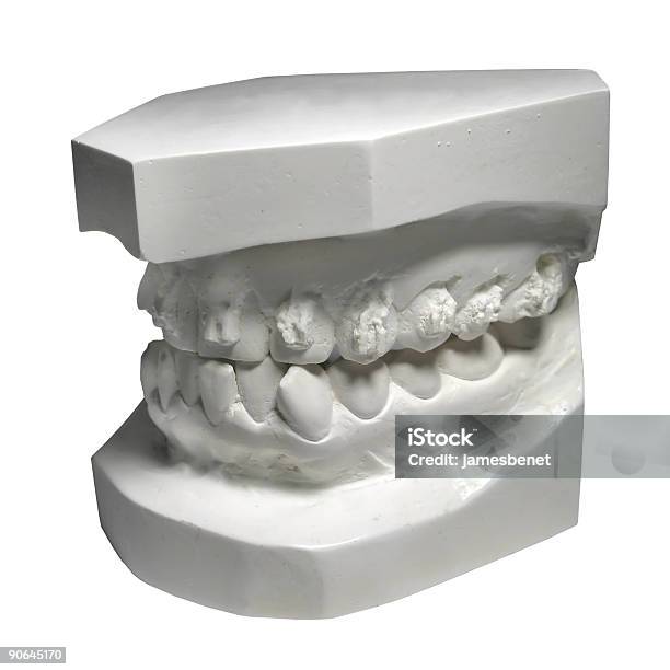 Denti Matrici Clip Percorso - Fotografie stock e altre immagini di Anatomia umana - Anatomia umana, Apparecchiatura odontoiatrica, Apparecchio ortodontico