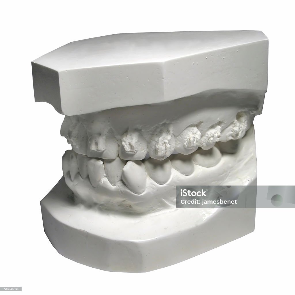 Teeth Mold Stock Photo - Download Image Now - Anatomy, Bent, Biting - iStock