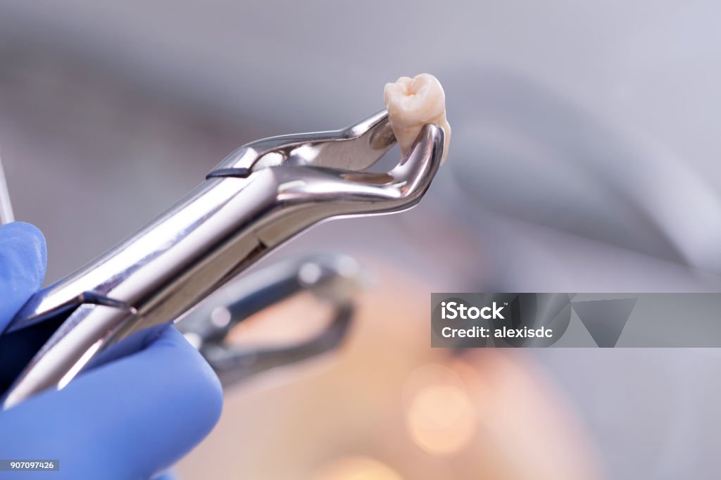 Équipement dentaire  - Photo de Dents libre de droits