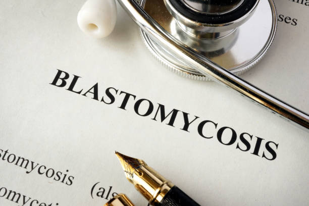 istock Document with word Blastomycosis in a hospital. 907699262