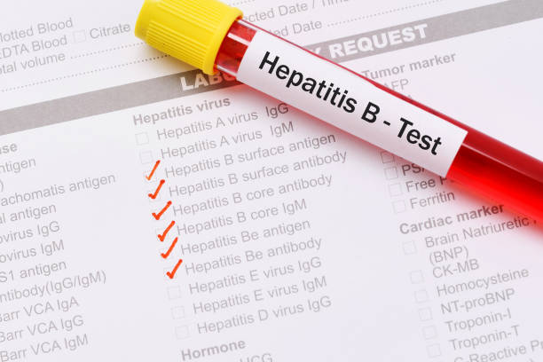Hepatitis B test stock photo
