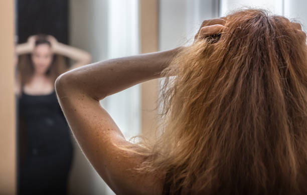 istock Woman with hands on head rear view. 907908744