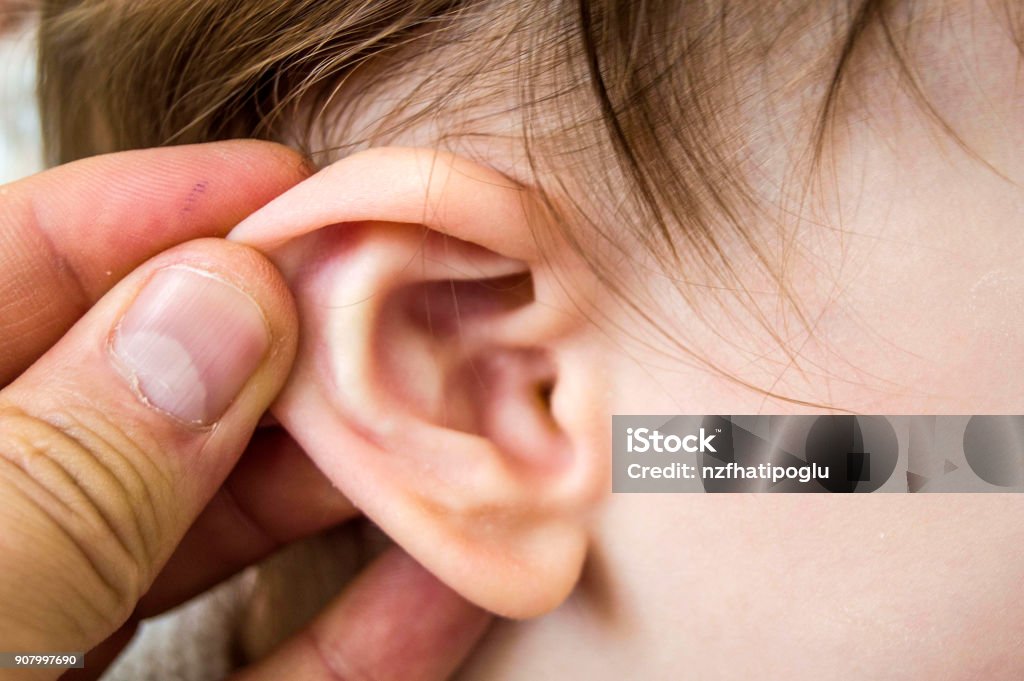 In the winter months, children's ears become more inflamed, middle ear inflammation in infants and doctors treatment Ear Stock Photo