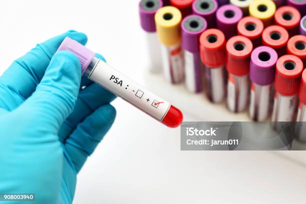 Psa Positive Stock Photo - Download Image Now - PSA, Medical Exam, Medical Test