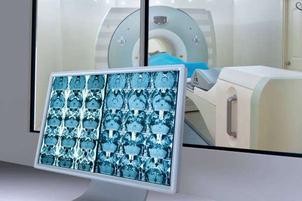 medizinische scan monitor - medical equipment x ray cancer oncology stock-fotos und bilder