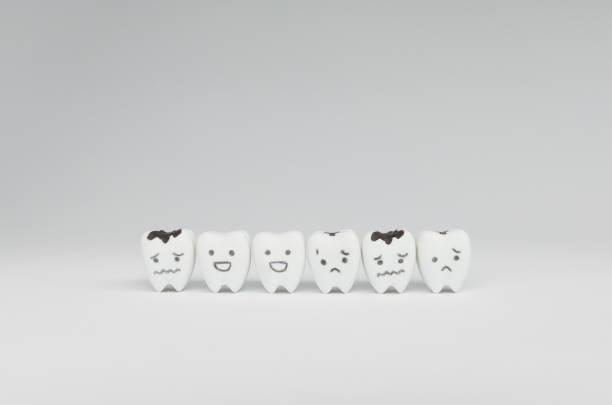 istock Decayed tooth model and good teeth for dental health care concept 908293470